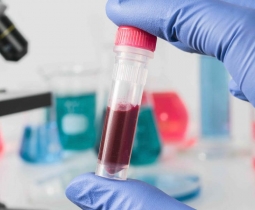 Hematologia Laboratorial